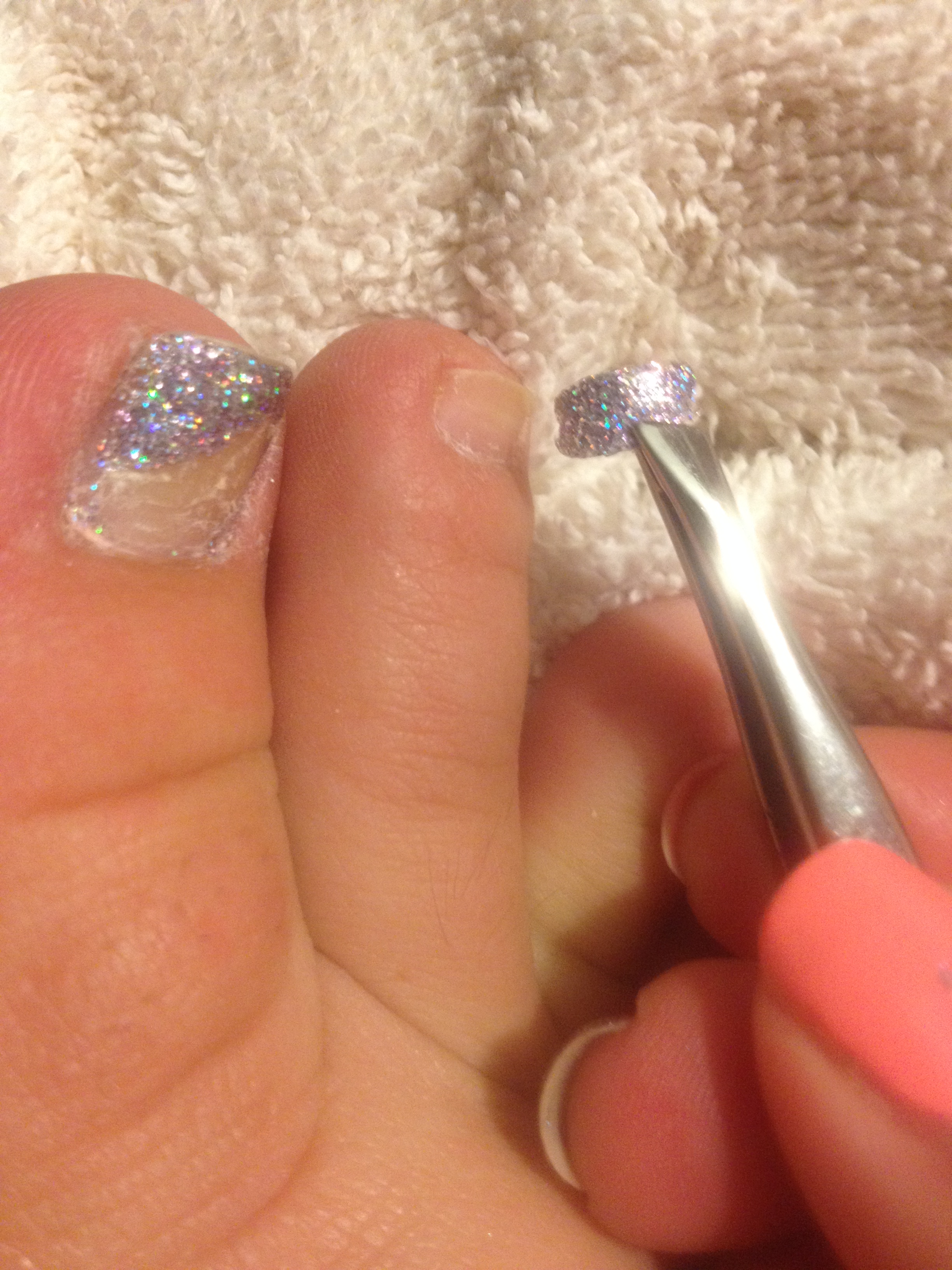 Toenail Falling Off: What to Do, Causes, and Recovery Time
